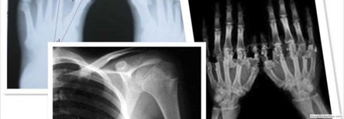 thermal_digital_x_ray_agfa_fuji_film_medical_for_radiography_examination
